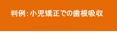 小児矯正での歯根吸収 小児矯正での歯根吸収