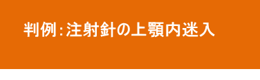 注射針の上顎内迷入と後遺障害 注射針の上顎内迷入と後遺障害